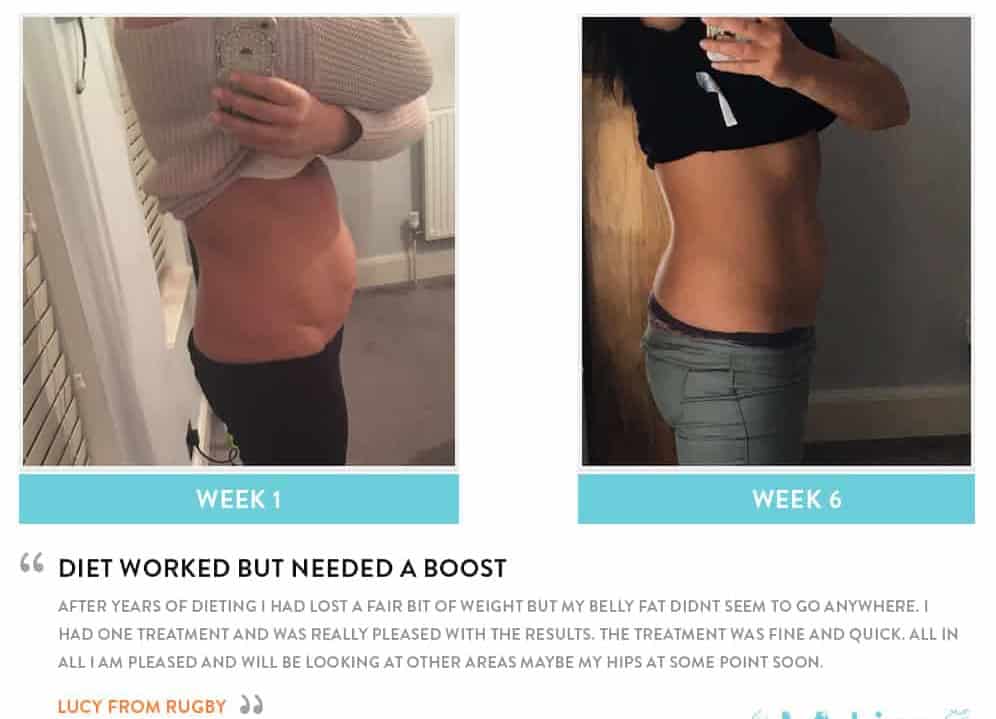 Before and After Dieting Greater London (Harrow)