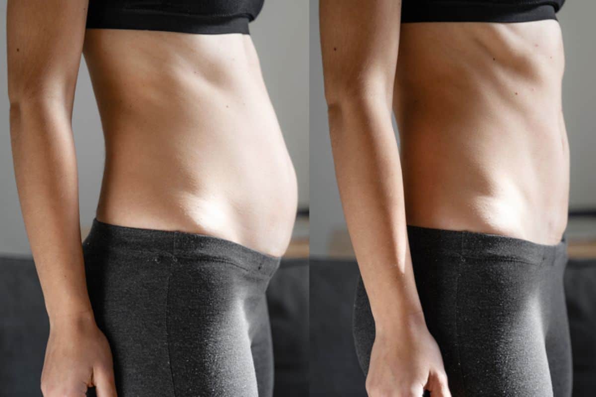 Post-Pregnancy: What Happens to Your Abdominal Muscles After Birth Greater London (Harrow)