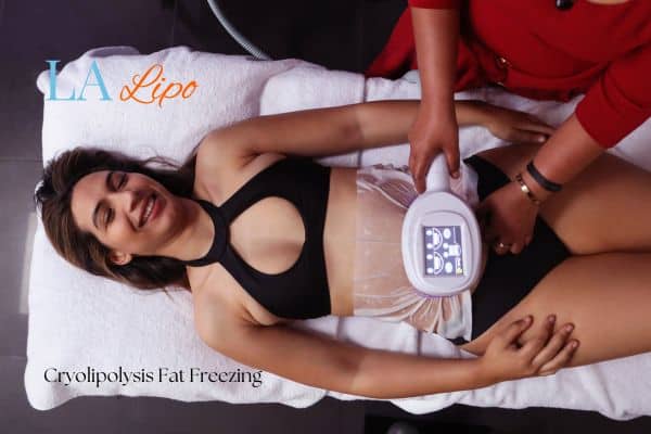 woman getting cryolipolysis Greater London (Harrow)