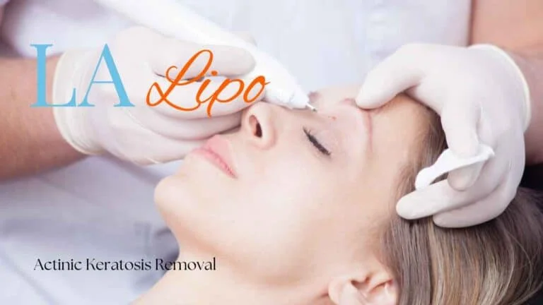 Woman receiving Actinic Keratosis Removal Treatment Greater London (Harrow)