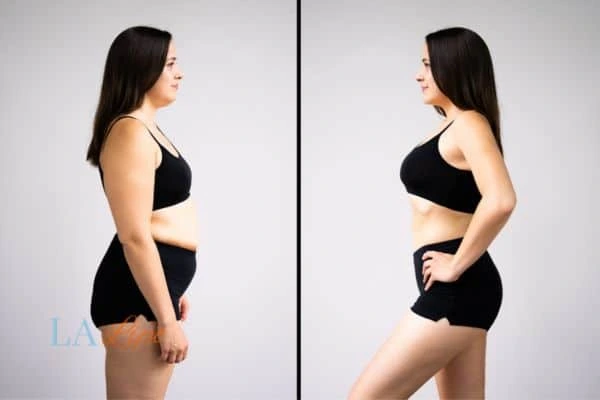 LA-EMS Body Sculpting Greater London (Harrow) results before and after of womans results on body toning.