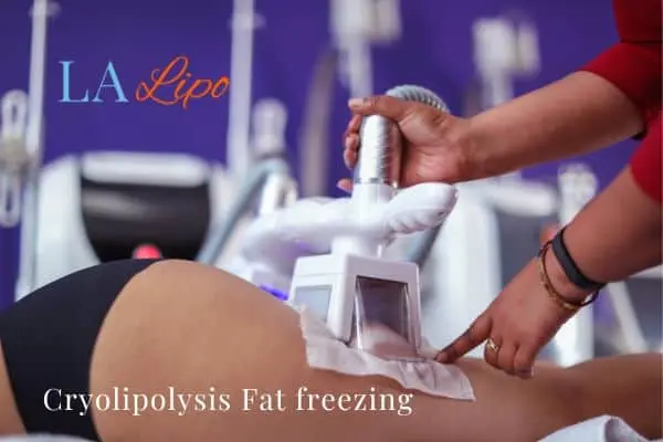 women getting fat freezing Greater London (Harrow)