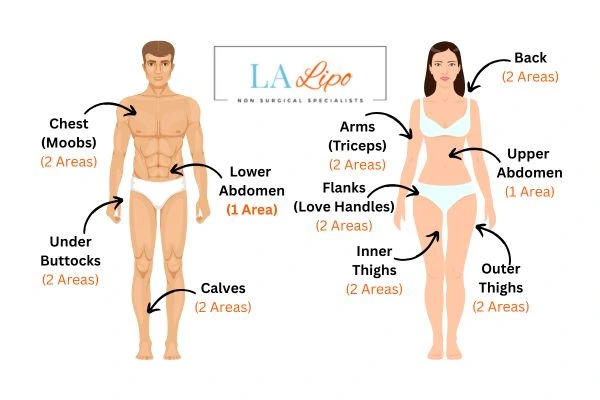 LA LIPO Cryolipolysis Areas Greater London (Harrow)