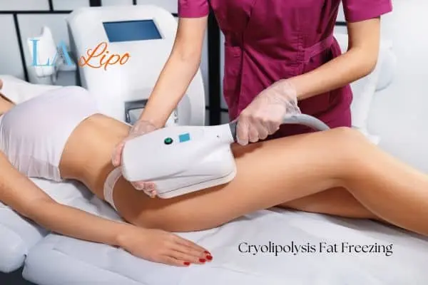 Woman receiving coolsculpting Greater London (Harrow) treatment on her thighs