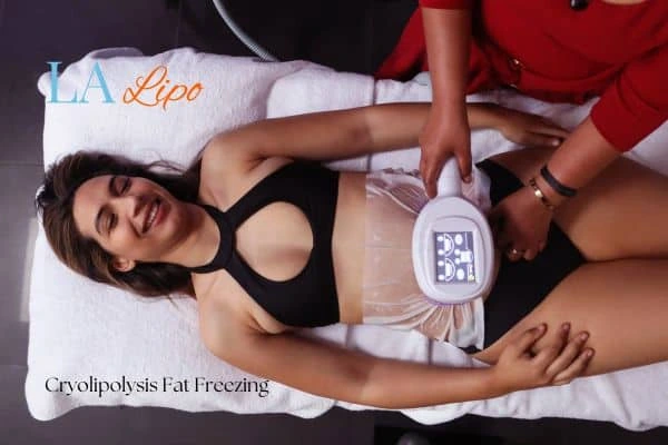 woman getting cryolipolysis Greater London (Harrow)