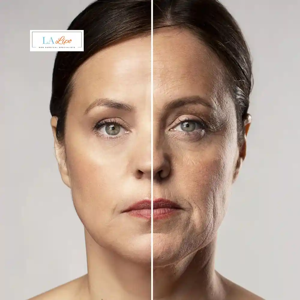 How Can You Tell If Non-Surgical Skin Tightening Is Right for You Greater London (Harrow)?