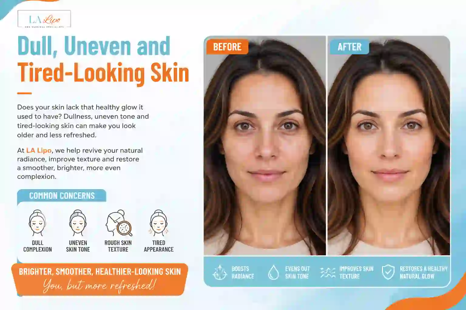 Sign #5: Dull, Uneven and Tired-Looking Skin Greater London (Harrow)