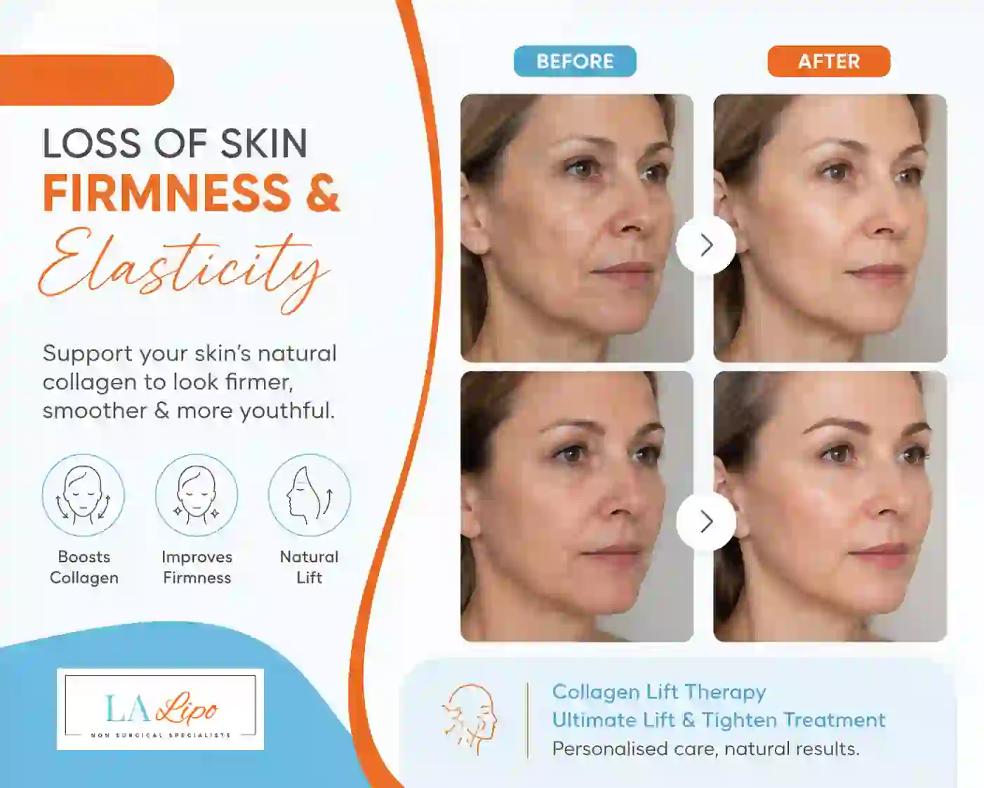 Sign #7: Loss of Skin Firmness and Elasticity Greater London (Harrow)